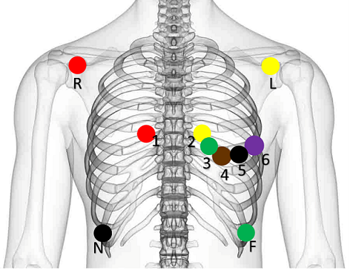 Posizionamento elettrodi
